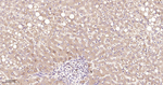 NME1/NME2 Antibody in Immunohistochemistry (Paraffin) (IHC (P))