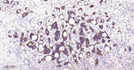 NME1/NME2 Antibody in Immunohistochemistry (Paraffin) (IHC (P))