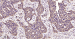 NME1/NME2 Antibody in Immunohistochemistry (Paraffin) (IHC (P))