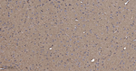 Pan Ras Antibody in Immunohistochemistry (Paraffin) (IHC (P))