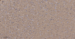 Pan Ras Antibody in Immunohistochemistry (Paraffin) (IHC (P))