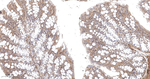 Pan Ras Antibody in Immunohistochemistry (Paraffin) (IHC (P))