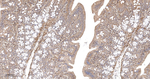 Pan Ras Antibody in Immunohistochemistry (Paraffin) (IHC (P))