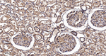 Pan Ras Antibody in Immunohistochemistry (Paraffin) (IHC (P))