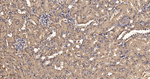 Pan Ras Antibody in Immunohistochemistry (Paraffin) (IHC (P))