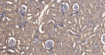 Pan Ras Antibody in Immunohistochemistry (Paraffin) (IHC (P))