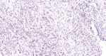 NUP50 Antibody in Immunohistochemistry (Paraffin) (IHC (P))