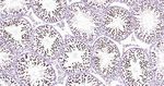NUP50 Antibody in Immunohistochemistry (Paraffin) (IHC (P))
