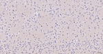 OTX1/2 Antibody in Immunohistochemistry (Paraffin) (IHC (P))