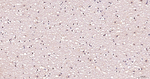 OTX1/2 Antibody in Immunohistochemistry (Paraffin) (IHC (P))
