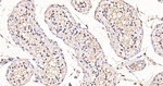 OTX1/2 Antibody in Immunohistochemistry (Paraffin) (IHC (P))