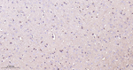 Phospho-PAK1/2/3 (Ser144, Ser141, Ser154) Antibody in Immunohistochemistry (Paraffin) (IHC (P))