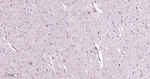 Phospho-PAK1/2/3 (Ser144, Ser141, Ser154) Antibody in Immunohistochemistry (Paraffin) (IHC (P))