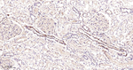 Phospho-PAK1/2/3 (Ser144, Ser141, Ser154) Antibody in Immunohistochemistry (Paraffin) (IHC (P))
