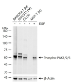 Phospho-PAK1/2/3 (Ser144, Ser141, Ser154) Antibody in Western Blot (WB)