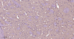 PAK1 Antibody in Immunohistochemistry (Paraffin) (IHC (P))