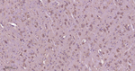 PAK1 Antibody in Immunohistochemistry (Paraffin) (IHC (P))