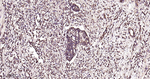PAK1 Recombinant Rabbit Monoclonal Antibody (14G3)