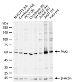 PAK1 Antibody in Western Blot (WB)