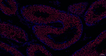 PIAS1/PIAS2 Antibody in Immunohistochemistry (Paraffin) (IHC (P))