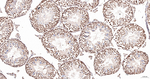 PIAS1/PIAS2 Antibody in Immunohistochemistry (Paraffin) (IHC (P))