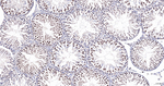 PIAS1/PIAS2 Antibody in Immunohistochemistry (Paraffin) (IHC (P))