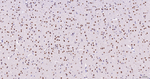 PIAS1/PIAS2 Antibody in Immunohistochemistry (Paraffin) (IHC (P))