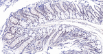 PIAS1/PIAS2 Antibody in Immunohistochemistry (Paraffin) (IHC (P))