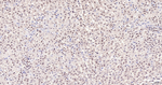 PIAS1/PIAS2 Antibody in Immunohistochemistry (Paraffin) (IHC (P))