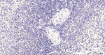 PIAS1/PIAS2 Antibody in Immunohistochemistry (Paraffin) (IHC (P))