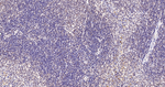 PIAS1/PIAS2 Antibody in Immunohistochemistry (Paraffin) (IHC (P))