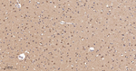 PLCB3 Antibody in Immunohistochemistry (Paraffin) (IHC (P))