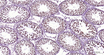 Phospho-POLR2A (Ser2) Antibody in Immunohistochemistry (Paraffin) (IHC (P))