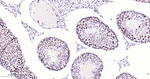 Phospho-POLR2A (Ser5) Antibody in Immunohistochemistry (Paraffin) (IHC (P))