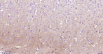 PKC Antibody in Immunohistochemistry (Paraffin) (IHC (P))