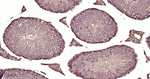 PKC Antibody in Immunohistochemistry (Paraffin) (IHC (P))