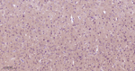 PKC Antibody in Immunohistochemistry (Paraffin) (IHC (P))