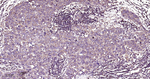 PKC Recombinant Rabbit Monoclonal Antibody (9A1)