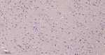 PKC Antibody in Immunohistochemistry (Paraffin) (IHC (P))