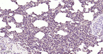 PKC Antibody in Immunohistochemistry (Paraffin) (IHC (P))