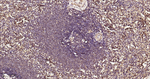 PKC Antibody in Immunohistochemistry (Paraffin) (IHC (P))