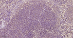PKC Antibody in Immunohistochemistry (Paraffin) (IHC (P))
