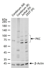 PKC Antibody in Western Blot (WB)