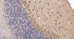 PKC delta/theta Recombinant Rabbit Monoclonal Antibody (15C18)