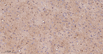 PKC delta/theta Antibody in Immunohistochemistry (Paraffin) (IHC (P))