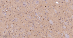 PKC delta/theta Antibody in Immunohistochemistry (Paraffin) (IHC (P))