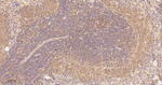 PKC delta/theta Antibody in Immunohistochemistry (Paraffin) (IHC (P))