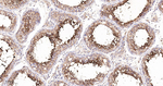 PKC delta/theta Antibody in Immunohistochemistry (Paraffin) (IHC (P))