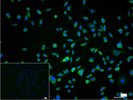 PKC epsilon Recombinant Rabbit Monoclonal Antibody (2B1)