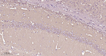 PKC epsilon Antibody in Immunohistochemistry (Paraffin) (IHC (P))